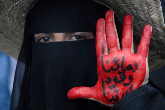 Йемен Сана военный госпиталь август 2020 год