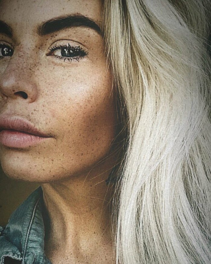 Аномально длинные ноги