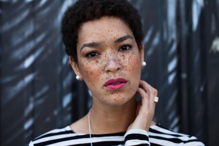 Люди с необычным цветом кожи