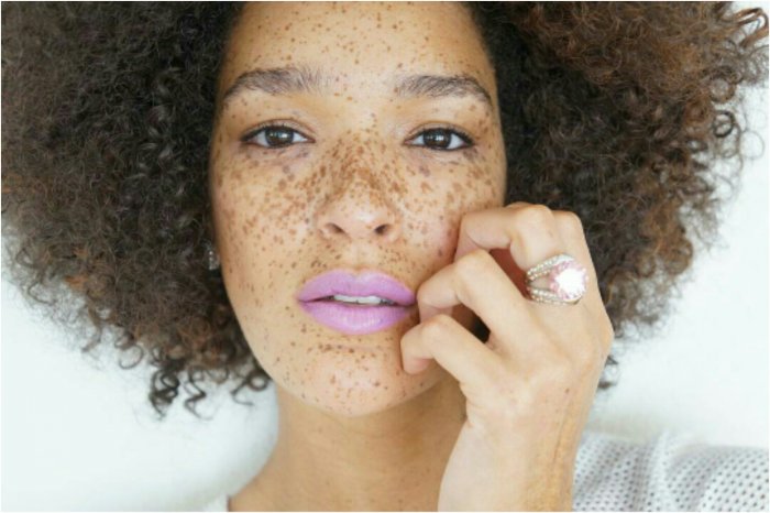 Редкий цвет кожи