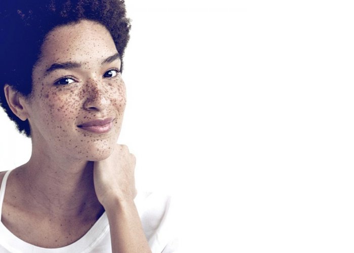 Необычный цвет кожи