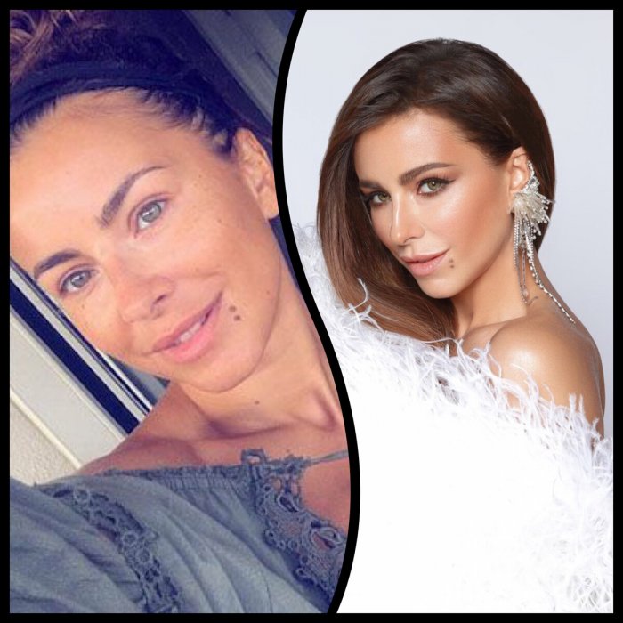 Ани Лорак поправилась 2020