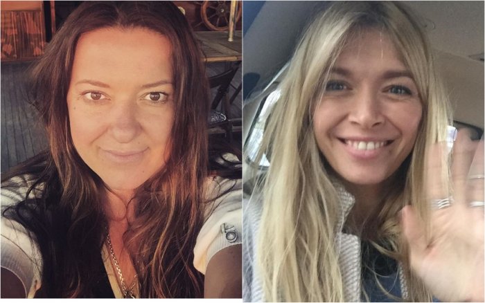 Ани Лорак без операции