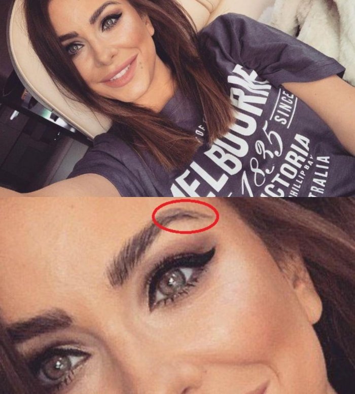 Ани Лорак до пластики