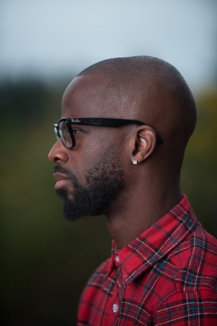 Брайан Майкл Смит до операции