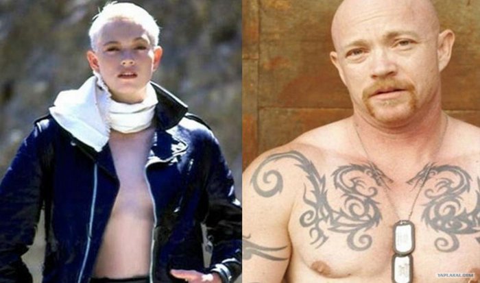 Бак Энджел до операции