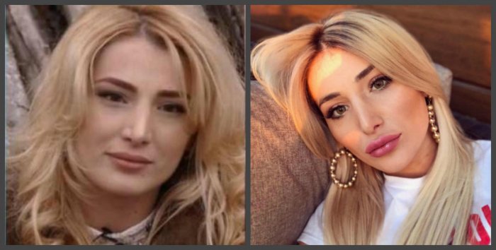 Тата Блюменкранц стрижка