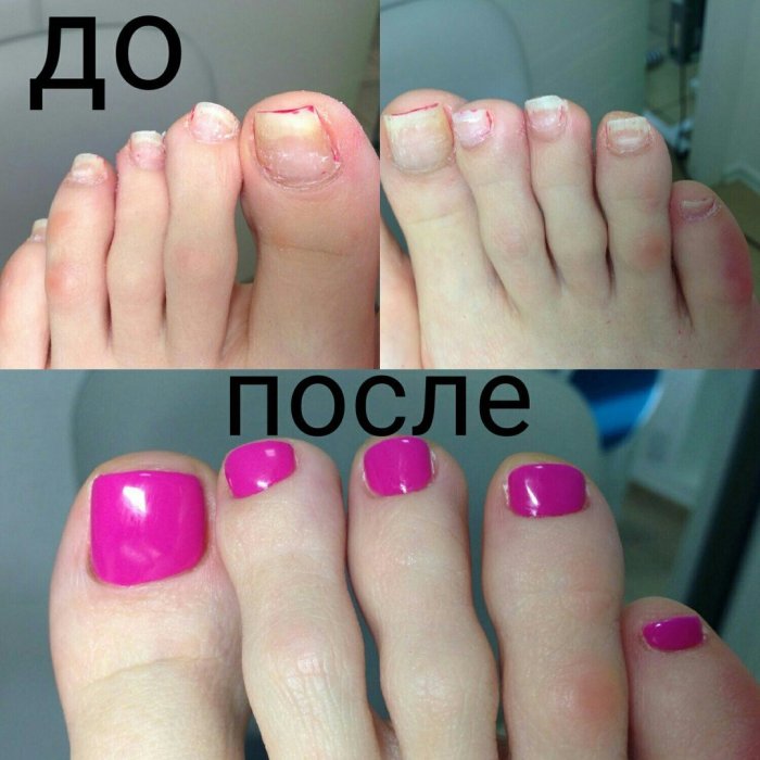 Нюдовый педикюр 2021 модные тенденции