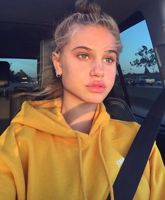 Meredith Mickelson до пластики